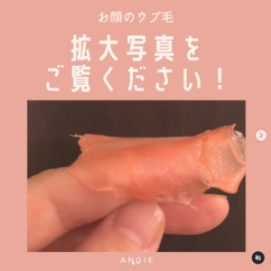 ワックス脱毛の実力、ここまでとれます!